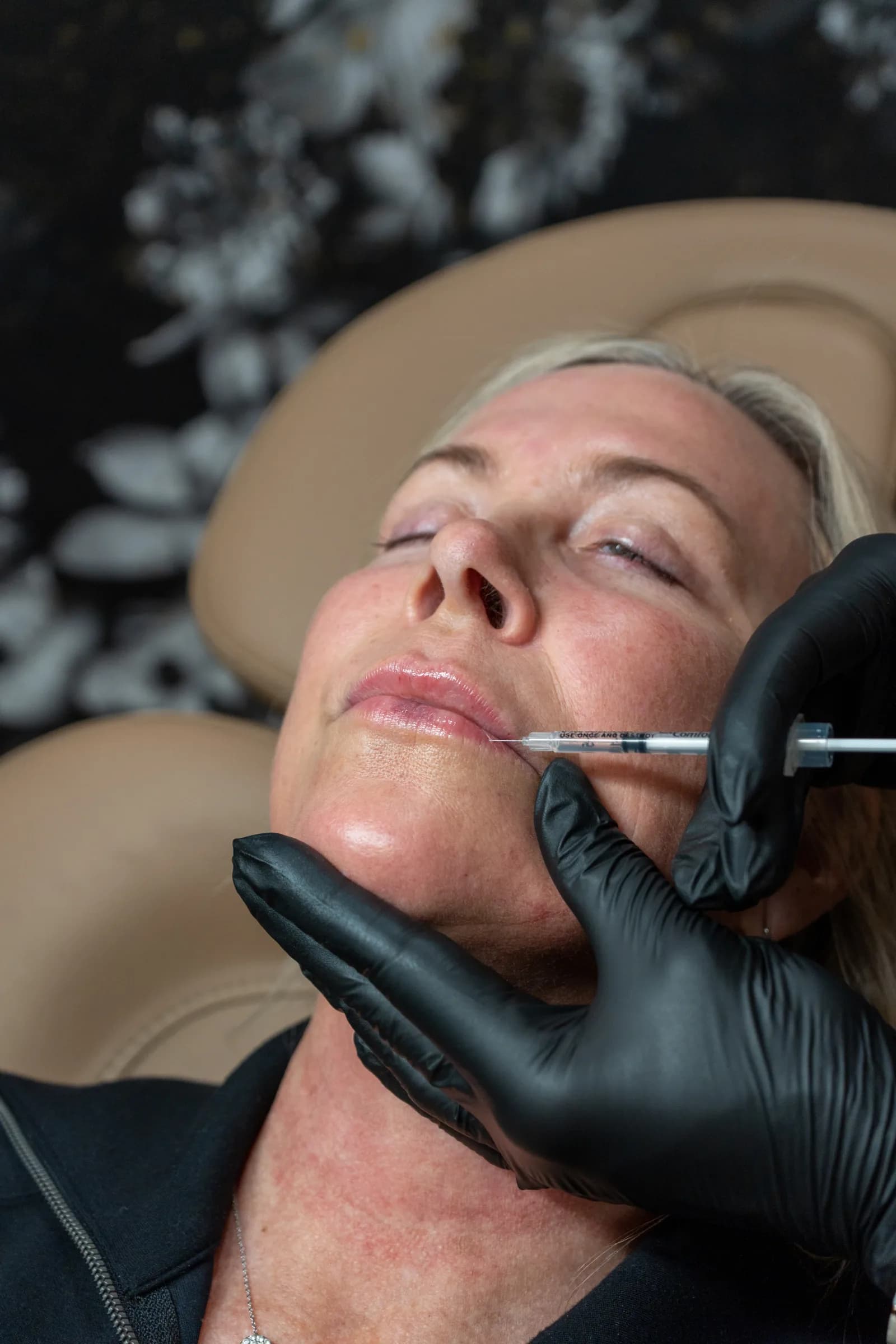 A provider injecting under a client's chin