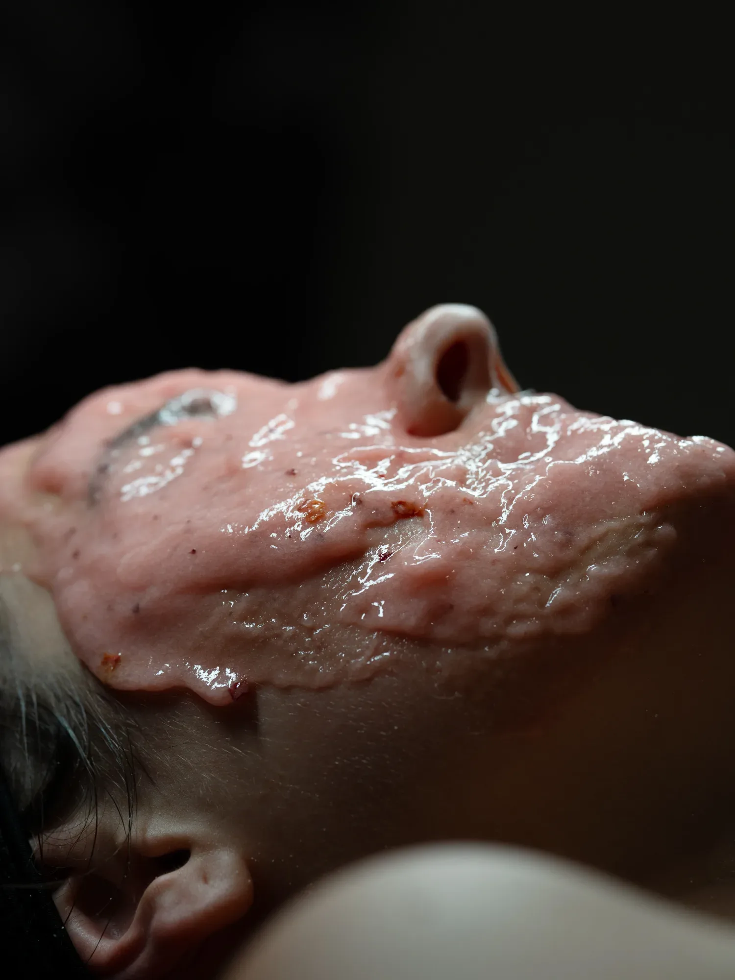 A client's face immediately after a laser pass