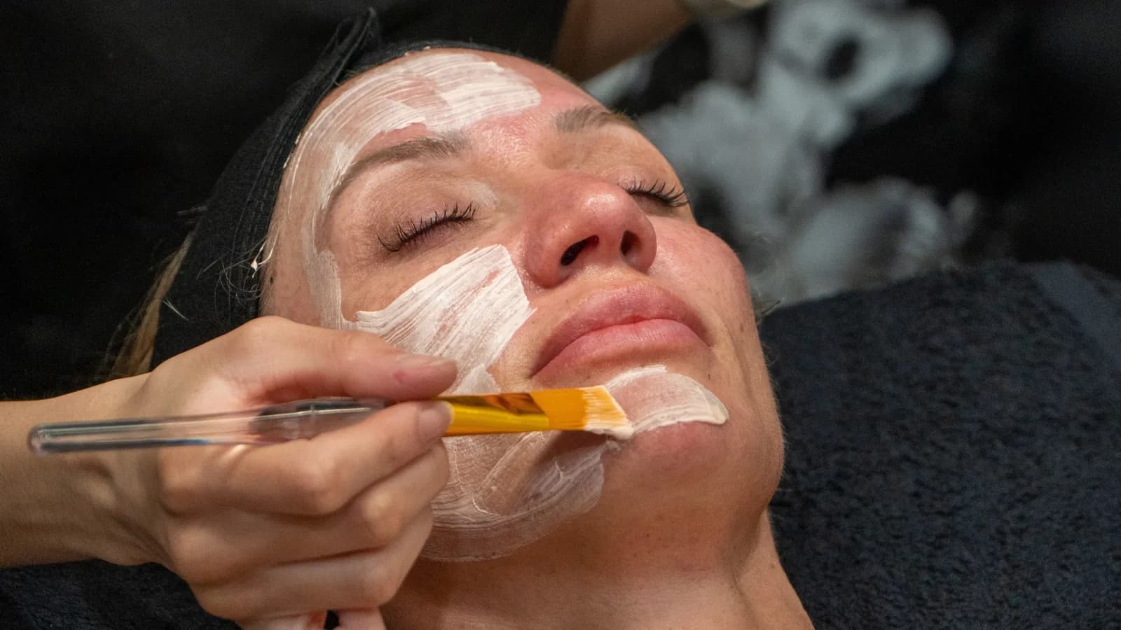The Benefits of Chemical Peels for Glowing Skin: Rejuvenate, Refresh, and Reveal Your Best You